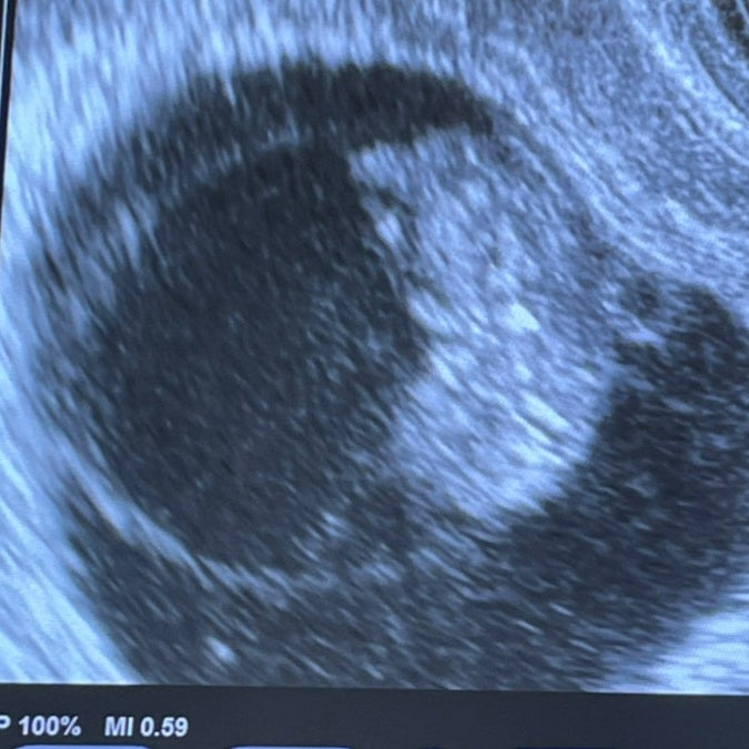 BABY LOVE　胎児ジュエリー®