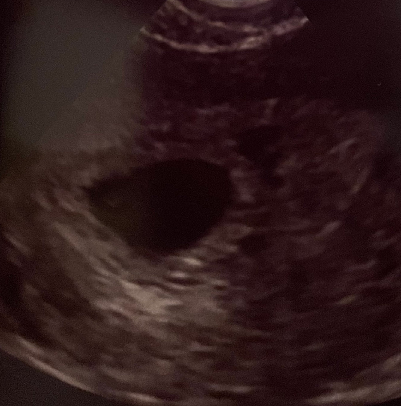 BABY LOVE　胎児ジュエリー®